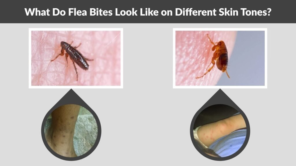 What Do Flea Bites Look Like on Different Skin Tones?
