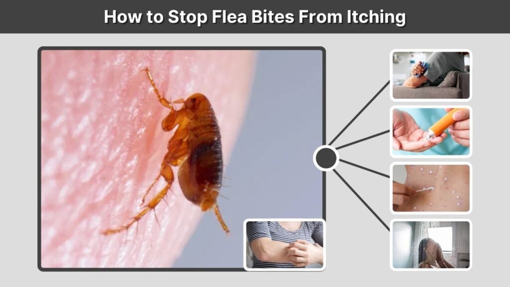 How to Stop Flea Bites From Itching