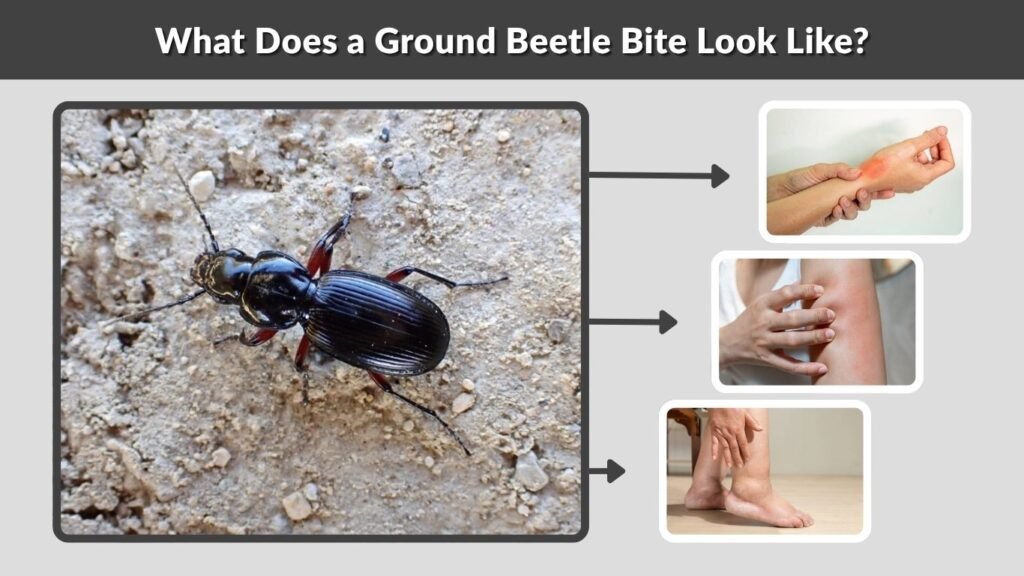 What Does a Ground Beetle Bite Look Like?