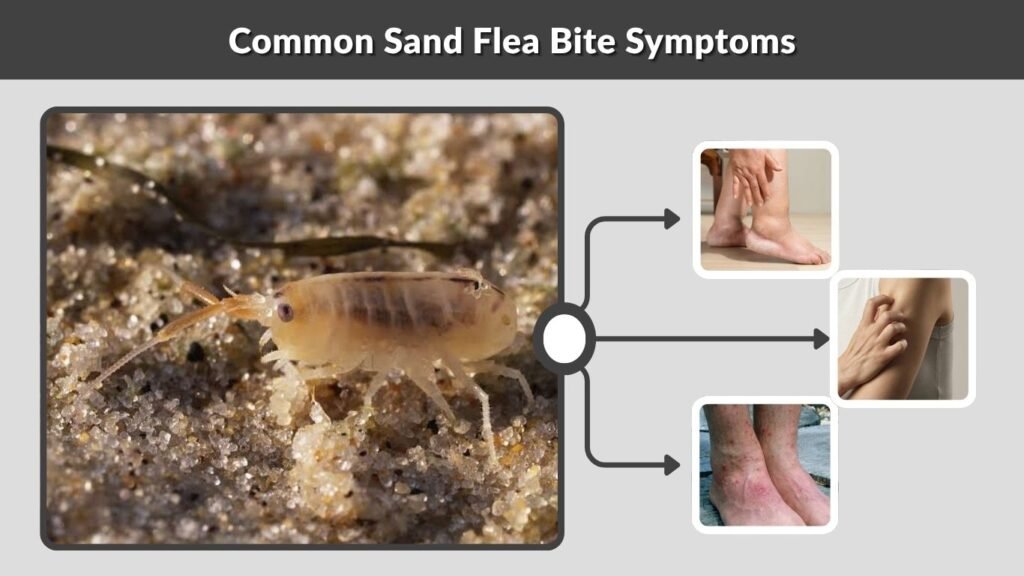 Common Sand Flea Bite Symptoms