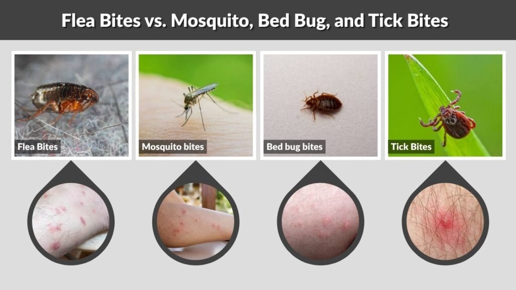 Flea Bites vs. Mosquito, Bed Bug, and Tick Bites