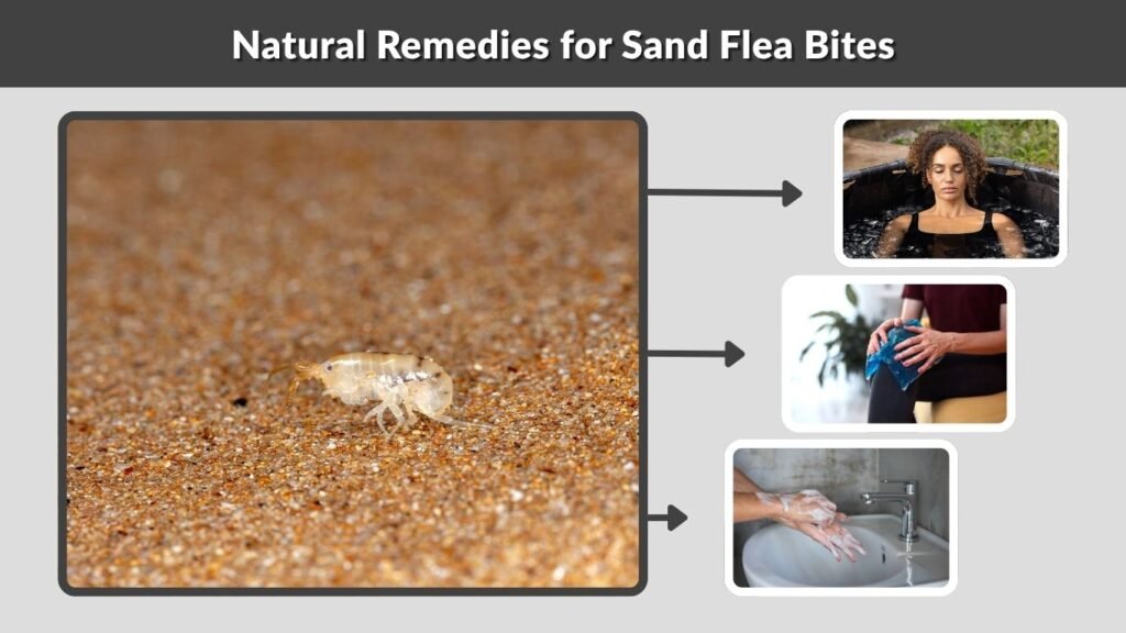 Natural Remedies for Sand Flea Bites