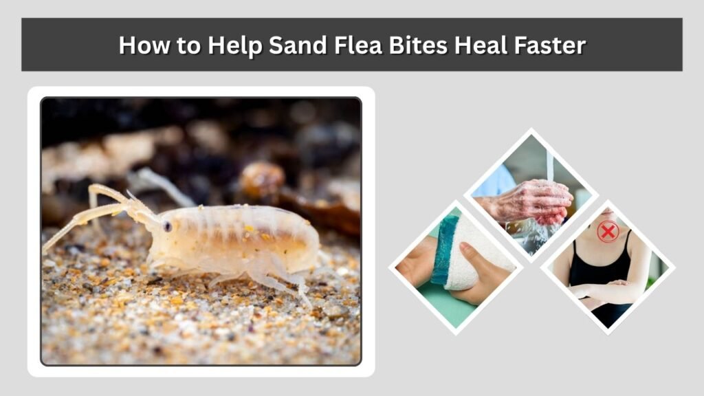 How to Help Sand Flea Bites Heal Faster
