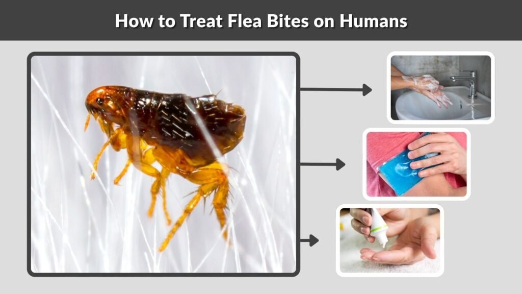 How to Treat Flea Bites on Humans
