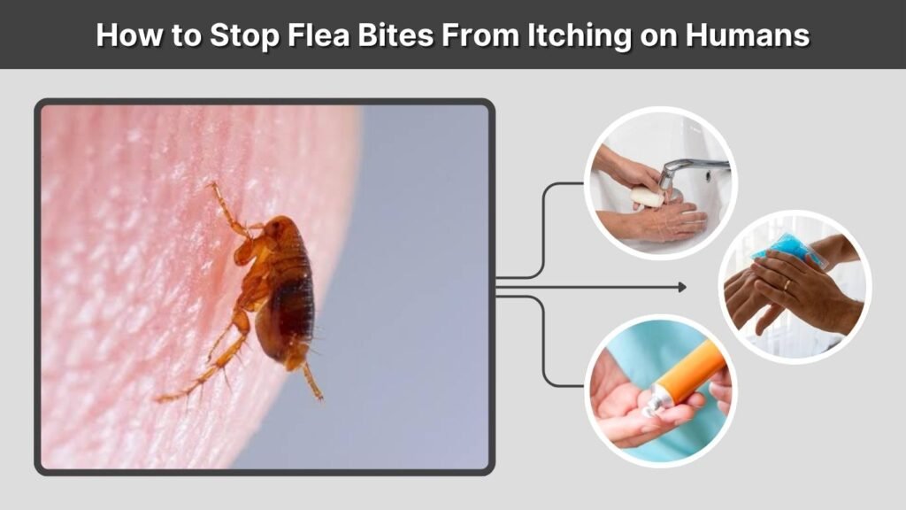 How to Stop Flea Bites From Itching on Humans