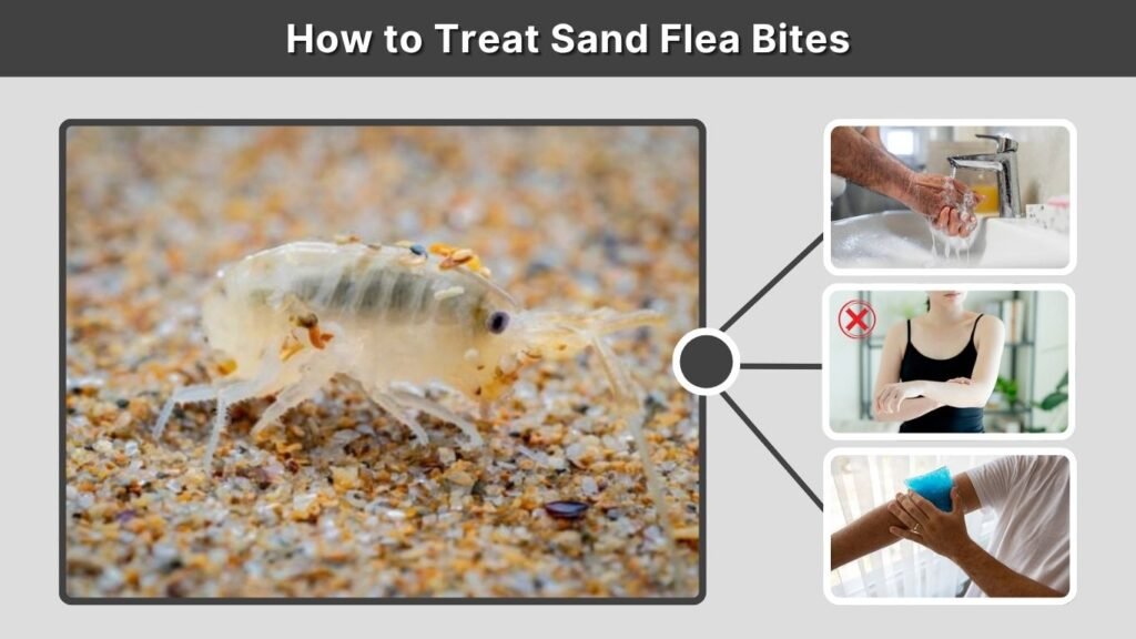 How to Treat Sand Flea Bites