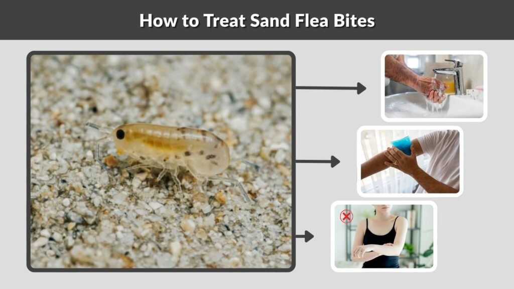 How to Treat Sand Flea Bites