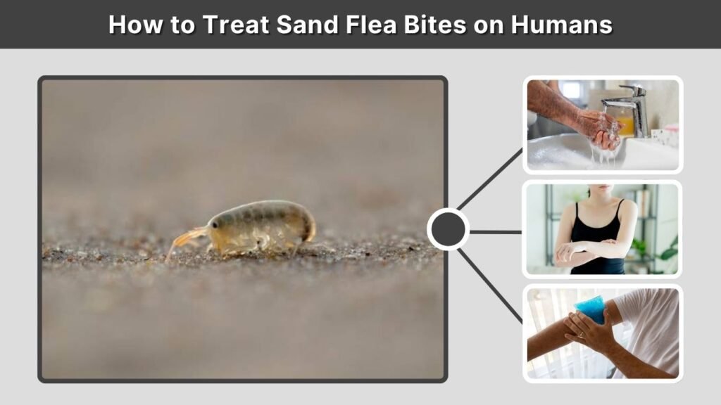 How to Treat Sand Flea Bites on Humans