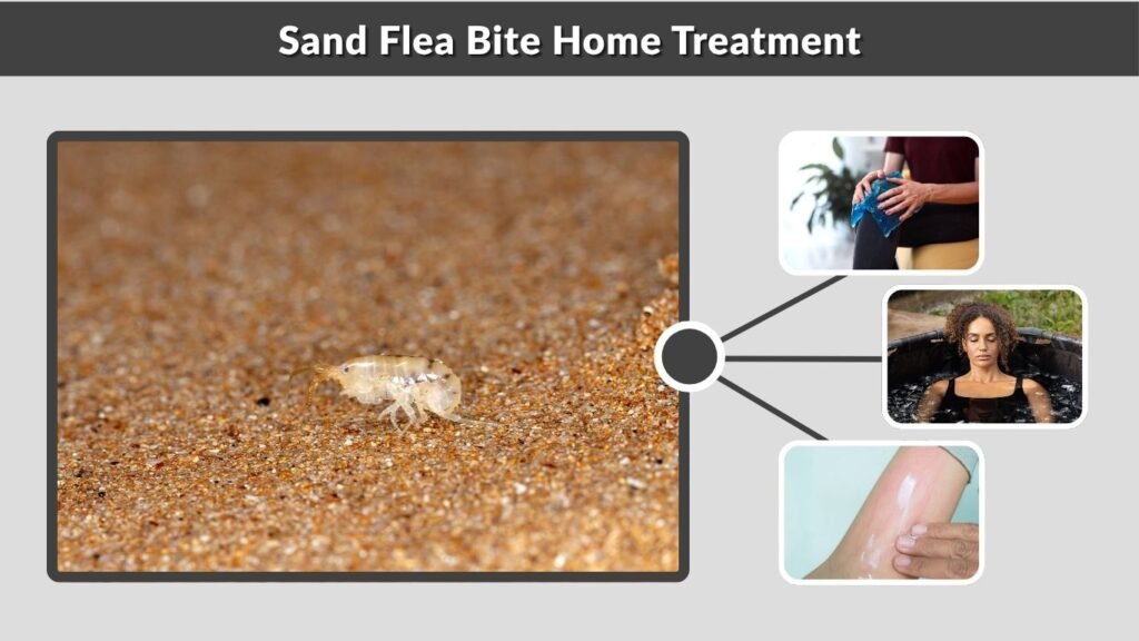 Sand Flea Bite Home Treatment