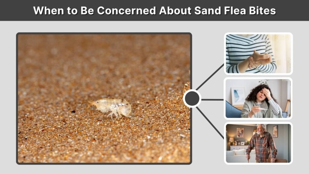 When to Be Concerned About Sand Flea Bites