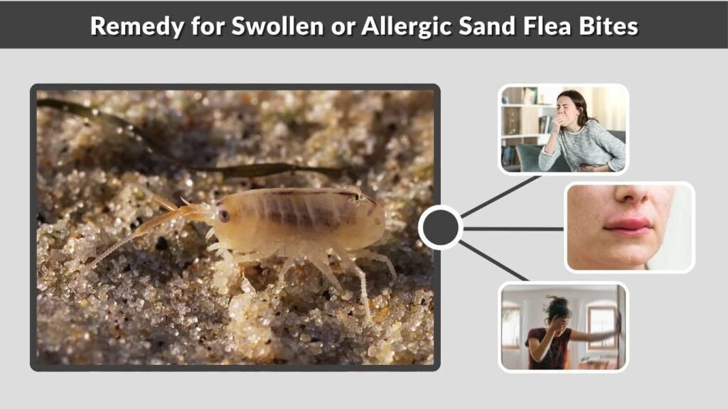 Remedy for Swollen or Allergic Sand Flea Bites