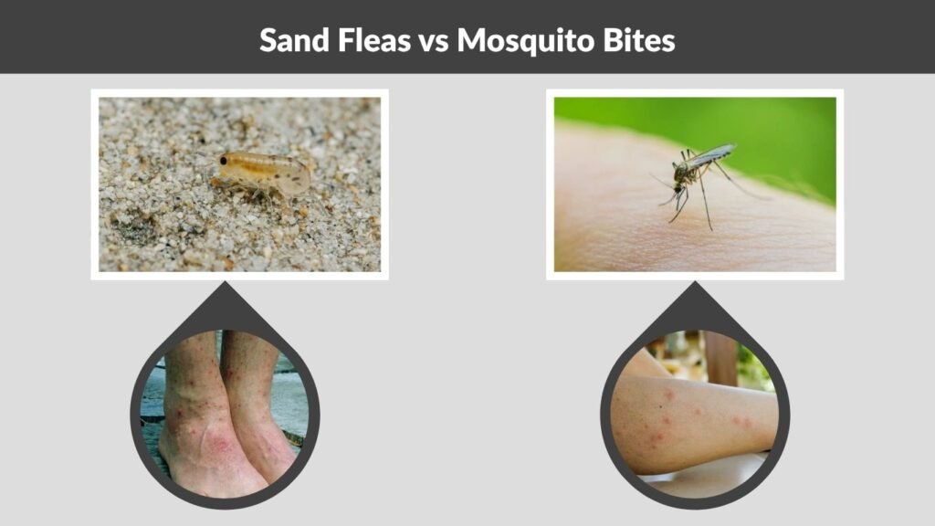 Sand Fleas vs Mosquito Bites