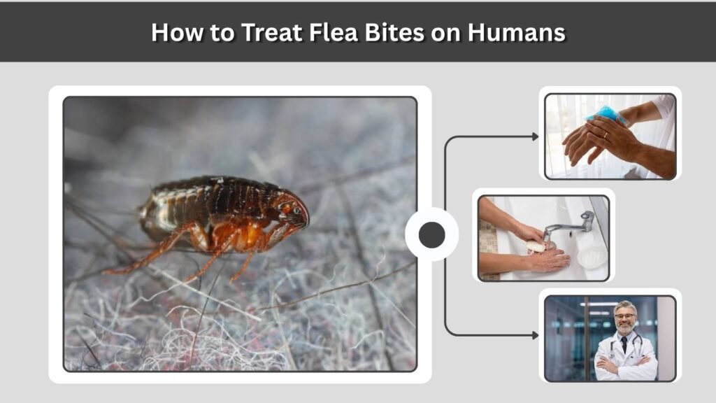 How to Treat Flea Bites on Humans