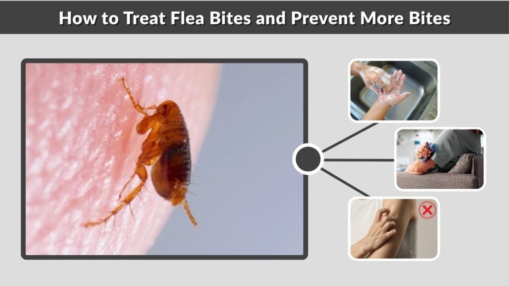 How to Treat Flea Bites and Prevent More Bites