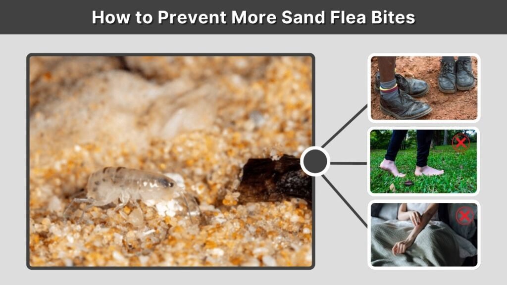 How to Prevent More Sand Flea Bites